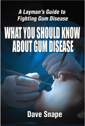 The Book: What You Should Know about Gum Disease