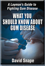 what you should know about gum disease : the book