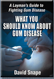 What You Should Know about Gum Disease